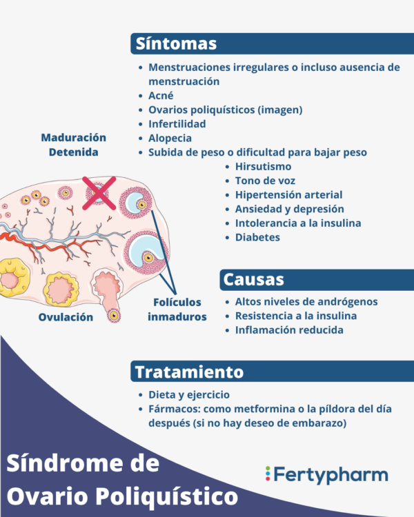 Síndrome de Ovario Poliquístico qué es y su tratamiento Fertypharm